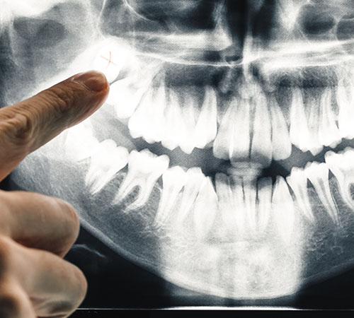 Digital X-rays El Paso, TX