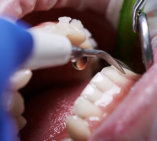 Gentle Cleanings El Paso, TX